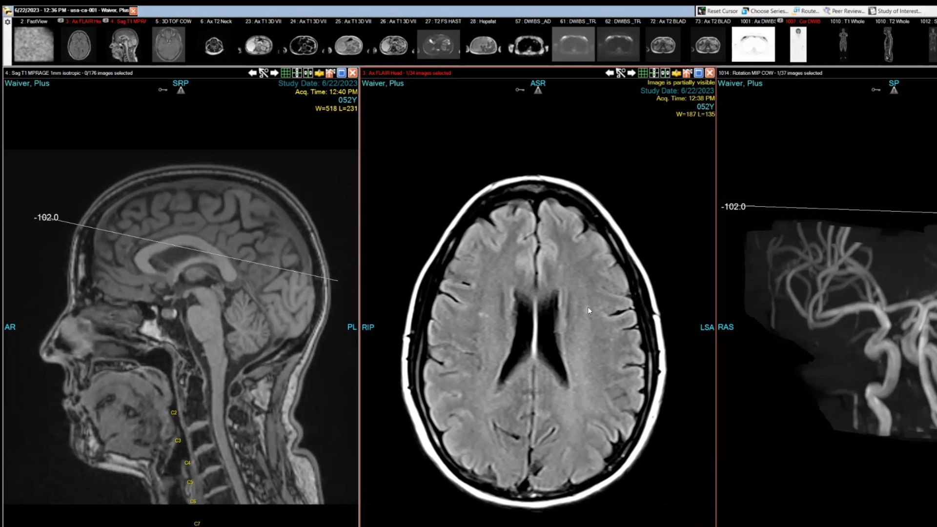 Brain diagrams from Jennifer Jolly's full-body MRI scan